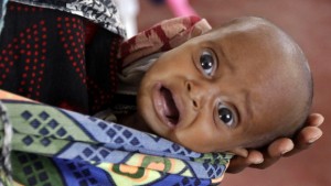 somalia_refugee_baby_AP11080307456_fullwidth_620x350