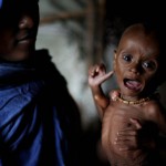 starvingchild_somalia starvingchild_somalia